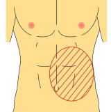 急性膵炎の症状（腹部側）